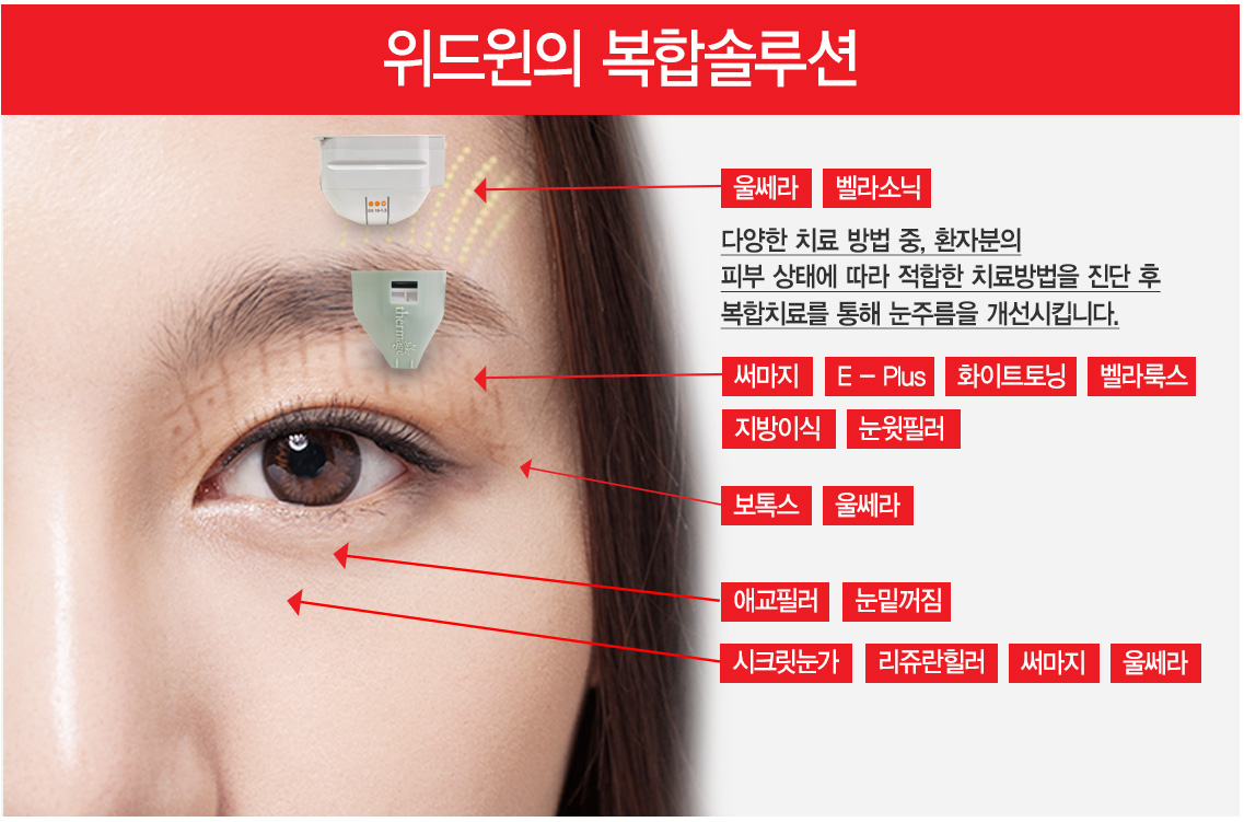 눈주름,눈주름제거,주름제거,눈가주름제거,눈가잔주름제거,주름제거