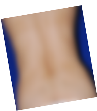 지방흡입,압구정지방흡입잘하는곳,지방성형,지방흡입전문의,압구정지방흡입,복부지방흡입