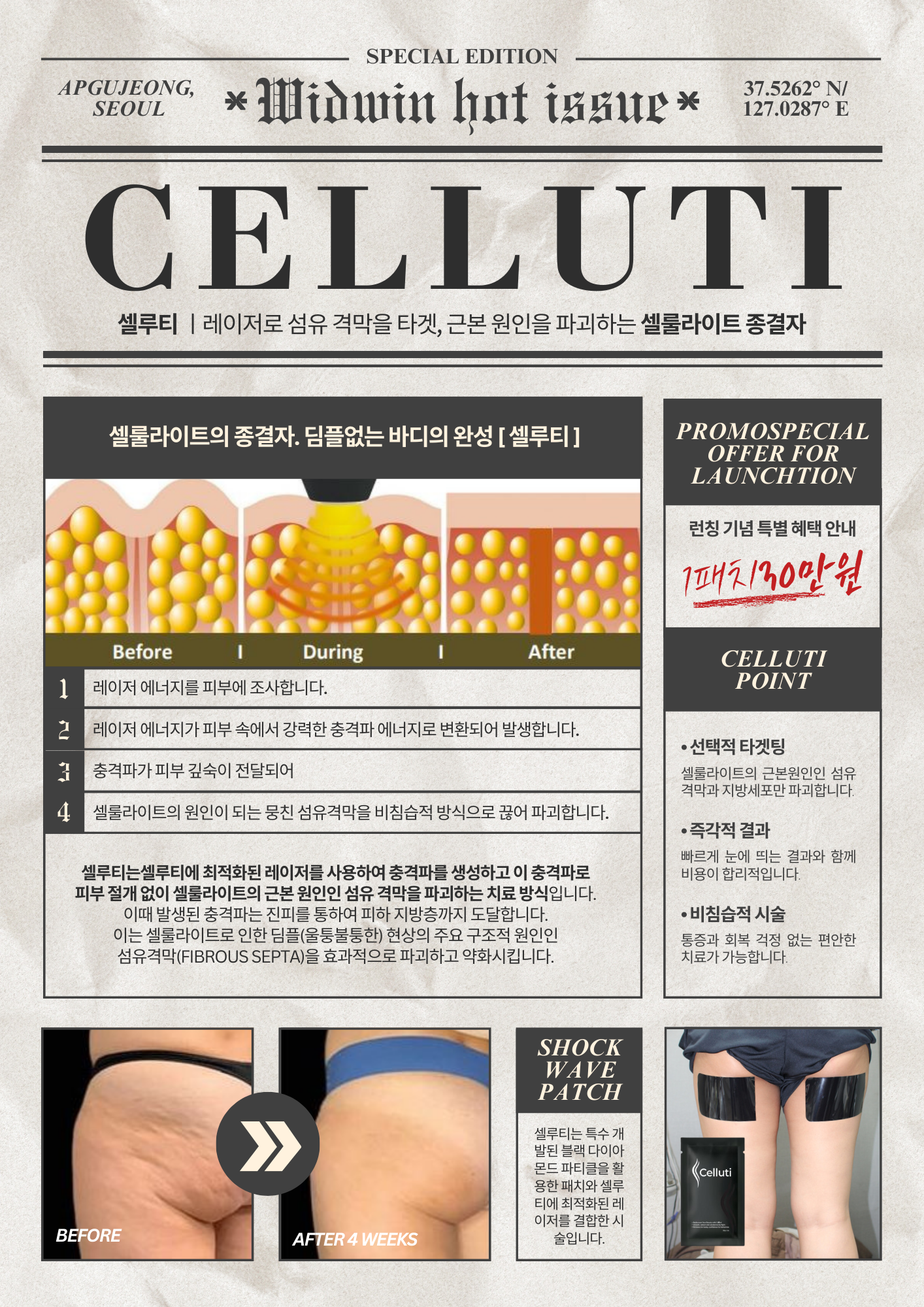 셀룰라이트 종결자! 위드윈피부과에서 셀루티(Celluti) 시술로 셀룰라이트 파괴